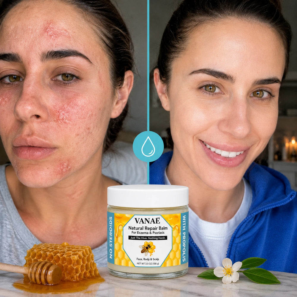 1. Soothes The Burn, Calms The Plaques Instantly