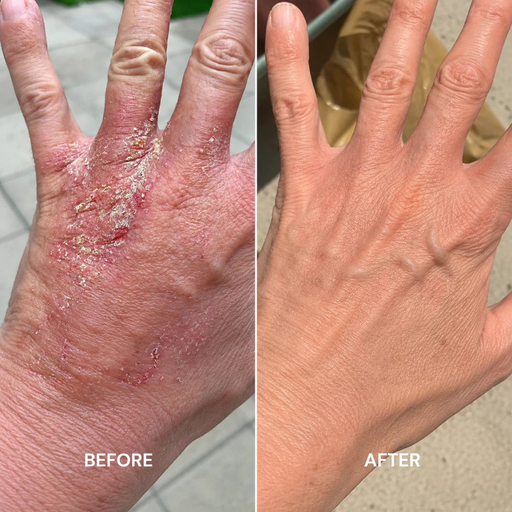 Built for Comfort.Designed for Real Skin Relief.