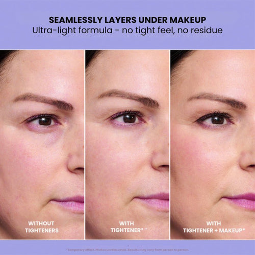 InstantLift+ Eye Tightener