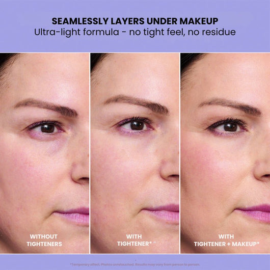 InstantLift+ Eye Tightener